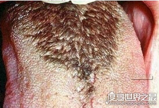 超恶心的密集恐惧症图片大全，密集测试图欢迎挑战(慎入)