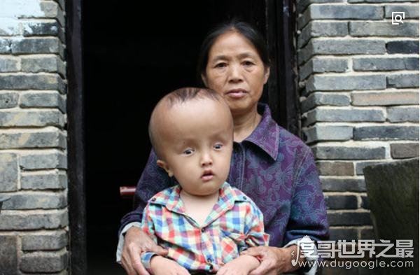 安徽阜阳大头娃娃事件，无良商家生产劣质奶粉害死无辜婴儿