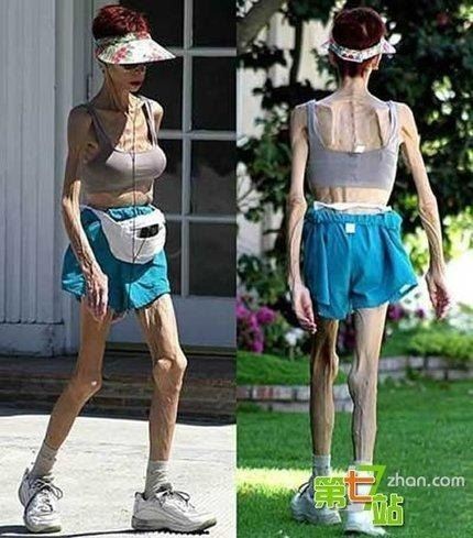 吉尼斯女性纪录大盘点，世界上乳房最多的女人竟有4个