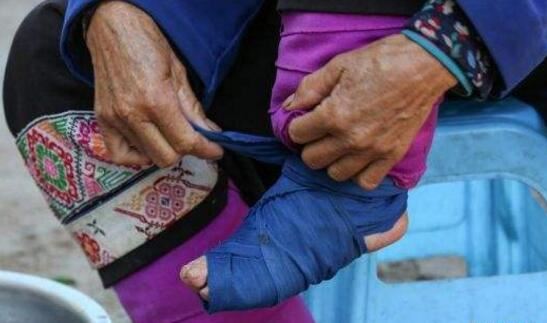 古代妇女缠足图片，残忍过程为满足男人变态审美