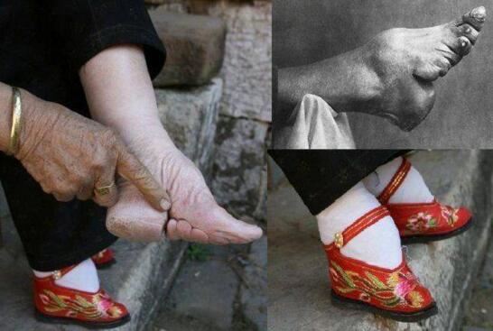 古代妇女缠足图片，残忍过程为满足男人变态审美