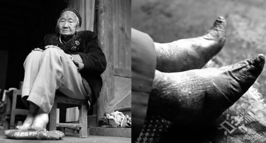 古代妇女缠足图片，残忍过程为满足男人变态审美