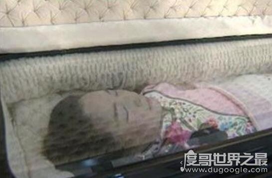 邓丽君怎么死的真相，脸上有巴掌印(男友拒绝尸检)