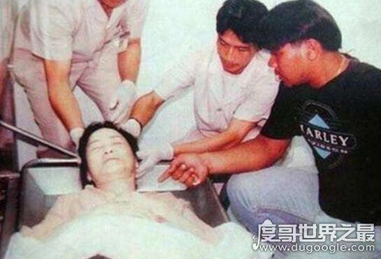 邓丽君怎么死的真相,脸上有巴掌印(男友拒绝尸检)