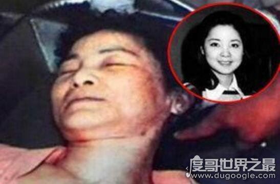 邓丽君怎么死的真相，脸上有巴掌印(男友拒绝尸检)