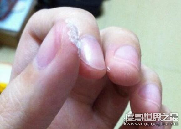 502胶水把手黏住了怎么办，教你几个小妙招轻松分开被黏住的手