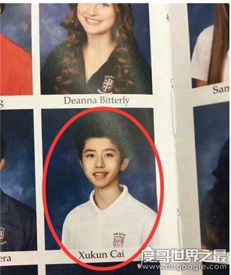 网传蔡徐坤整容是假消息，带个牙套也算整？(从小帅到大)