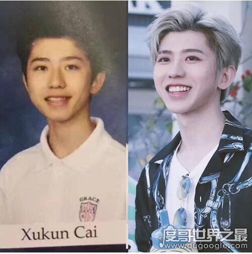 网传蔡徐坤整容是假消息，带个牙套也算整？(从小帅到大)