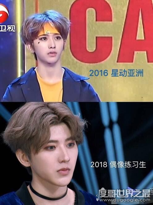 网传蔡徐坤整容是假消息，带个牙套也算整？(从小帅到大)