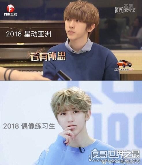 网传蔡徐坤整容是假消息，带个牙套也算整？(从小帅到大)