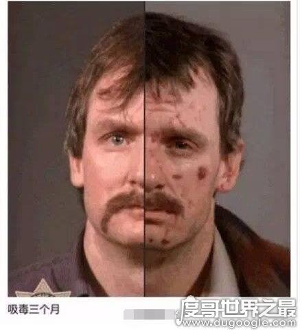 史上最厉害的毒品，吸食僵尸浴盐会沦为丧尸(远离毒品)