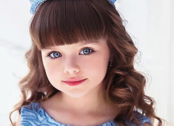 日本歌舞伎面谱综合症，因容貌酷似化妆后的歌舞伎而得名