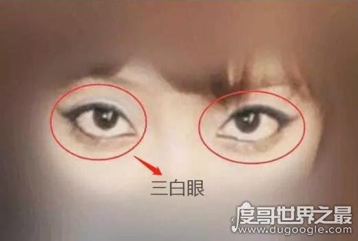 什么是三白眼，就是眼睛瞳仁很靠上或是很靠下(看起来眼白很多)