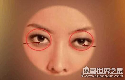 什么是三白眼，就是眼睛瞳仁很靠上或是很靠下(看起来眼白很多)