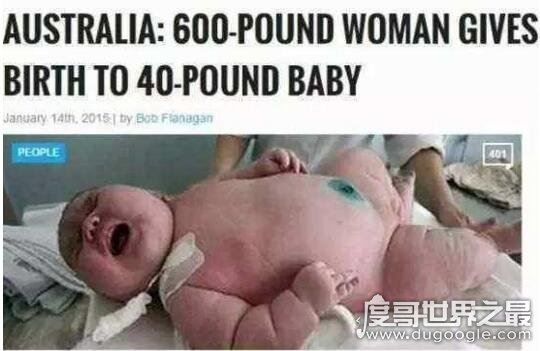 世界上生下来最重的婴儿,2016年澳洲孕妇产下36斤巨婴
