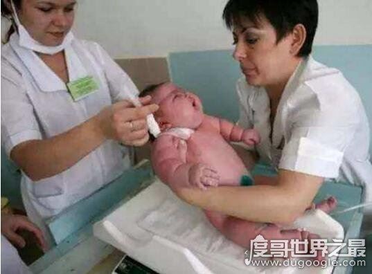 世界上生下来最重的婴儿,2016年澳洲孕妇产下36斤巨婴