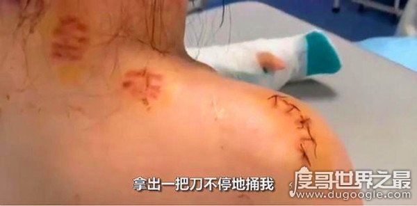 南京一女子被室友追求者捅刀，室友前往医院探望一次后失去联系