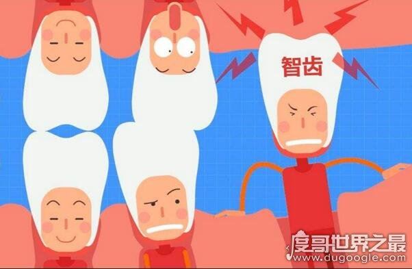 不需要拔的智齿图片,这4种情况下的智齿其实并不需要拔