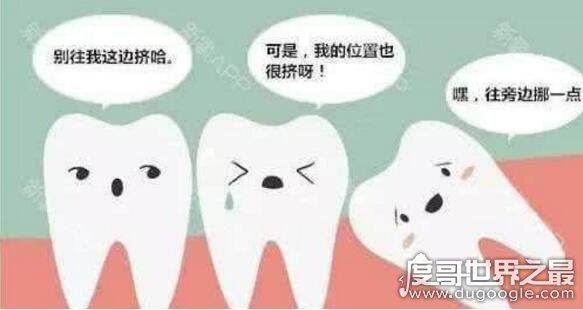 不需要拔的智齿图片，这4种情况下的智齿其实并不需要拔