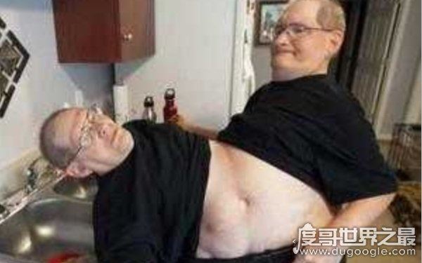 世界上最漂亮的连体人，曾出演电影《大鱼》（坚强独立）