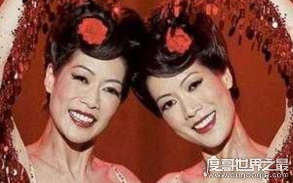 世界上最漂亮的连体人,曾出演电影《大鱼》(坚强独立)
