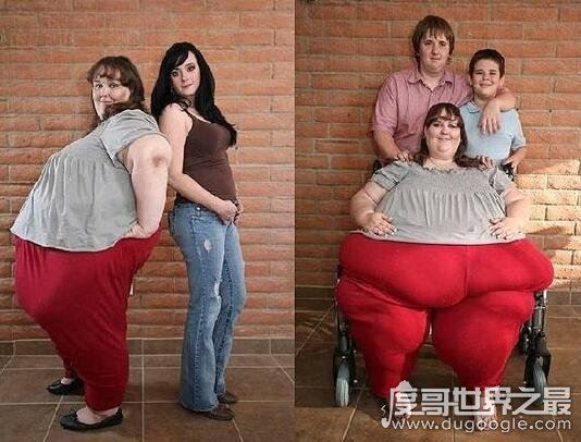 世界上最重的人苏珊娜·埃曼 ,也是世界上最胖的人(有1450斤)