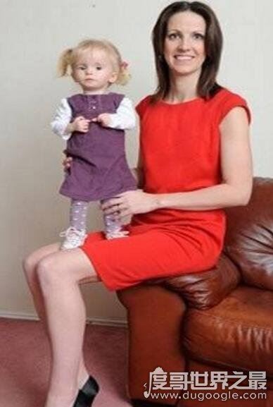 现实中的拇指姑娘盘点，英国3岁女孩仅有8公斤重(组图)