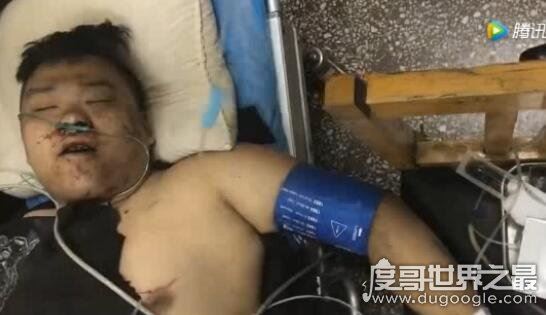 yy夏可可车祸发生经过，夏可可徒弟秦始皇伤重去世