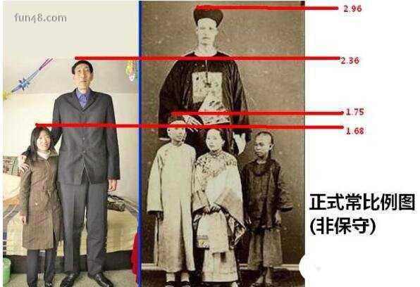 世界上最高的人，中国巨人詹世钗高达3.19米