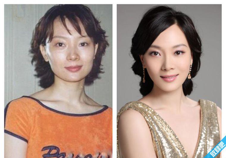 陈数整容前后照片对比曝光 陈数早期被称为“方脸男人婆”