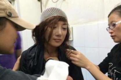 李依晓暴奶图片|李依晓差点因叶璇毁容现被名导看中大火