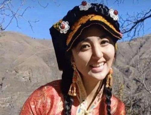 网红拉姆遭前夫纵火重度烧伤事件全过程