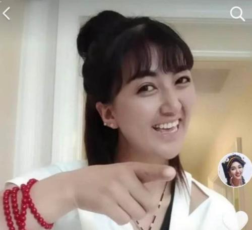 网红拉姆遭前夫纵火重度烧伤事件全过程