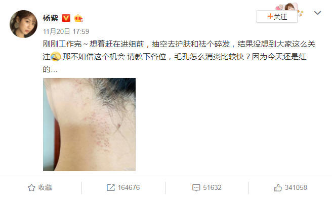 杨紫现身整形医院惹非议，被疑整容，工作人员解释称只是简单护理