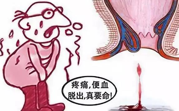 经常大便用力过度的后果