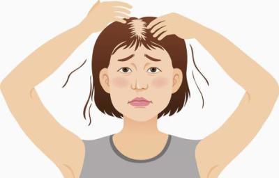 女性脱发的3种类型