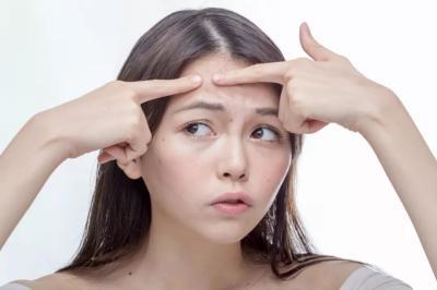用避孕药治疗痘痘