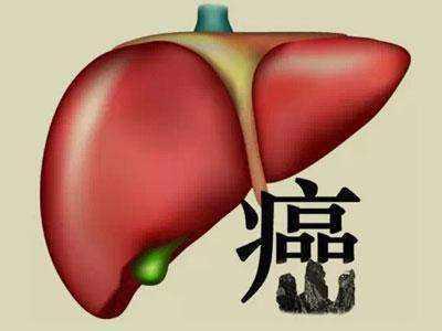 肝癌有哪些症状，怎么预防