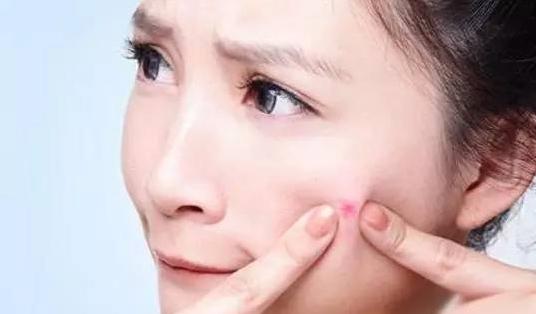 9个可能导致粉刺的坏习惯