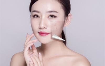 长痘痘的8个原因-以及如何实际治疗