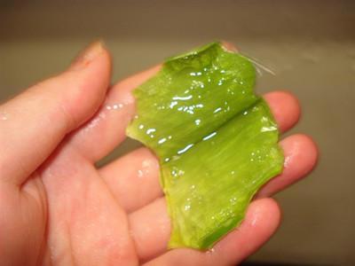 芦荟能祛痘吗?
