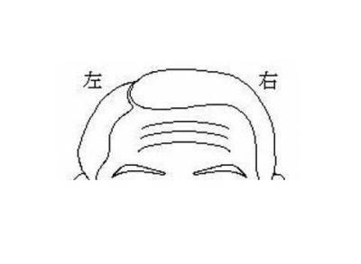 额头上皱纹怎么缓解