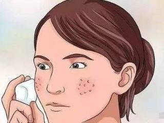 有效的祛斑土方法