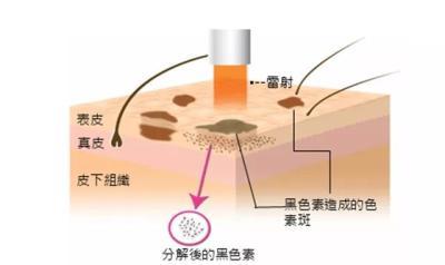 烟酰胺是什么?能祛斑吗?