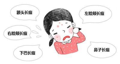 爱长痘痘的伙伴怎么调理呢?