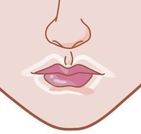 嘴周围爱长痘是什么原因