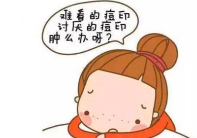 简单有效的祛除痘印的窍门