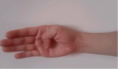 手腕没伤但一扭动就疼怎么治疗