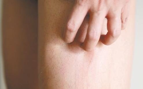 皮肤老是反复痒是怎么回事