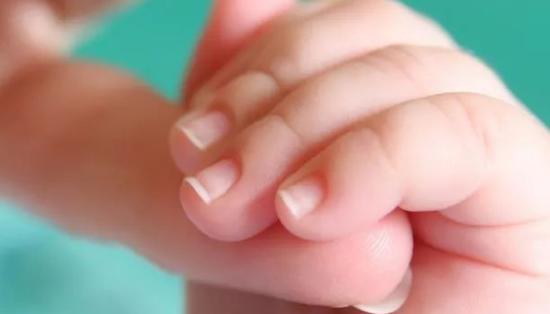 治疗冻伤的偏方有哪些